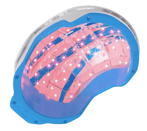 Hair restoration device 2